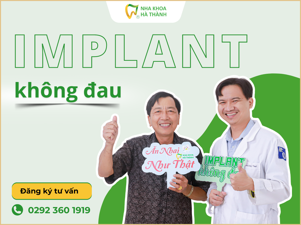 trong-rang-implant-nha-khoa-ha-thanh