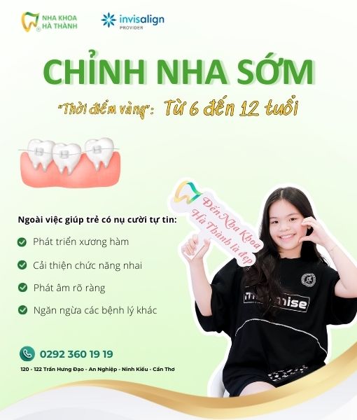 nha-khoa-ha-thanh-chinh-nha-som-banner2