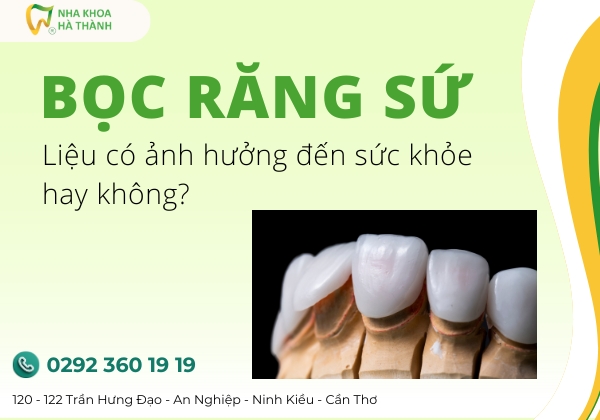 boc-rang-su-nha-khoa-ha-thanh