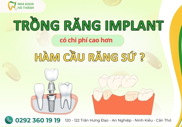 trong-rang-implant-ham-cau-rang-su-nha-khoa-ha-thanh 11