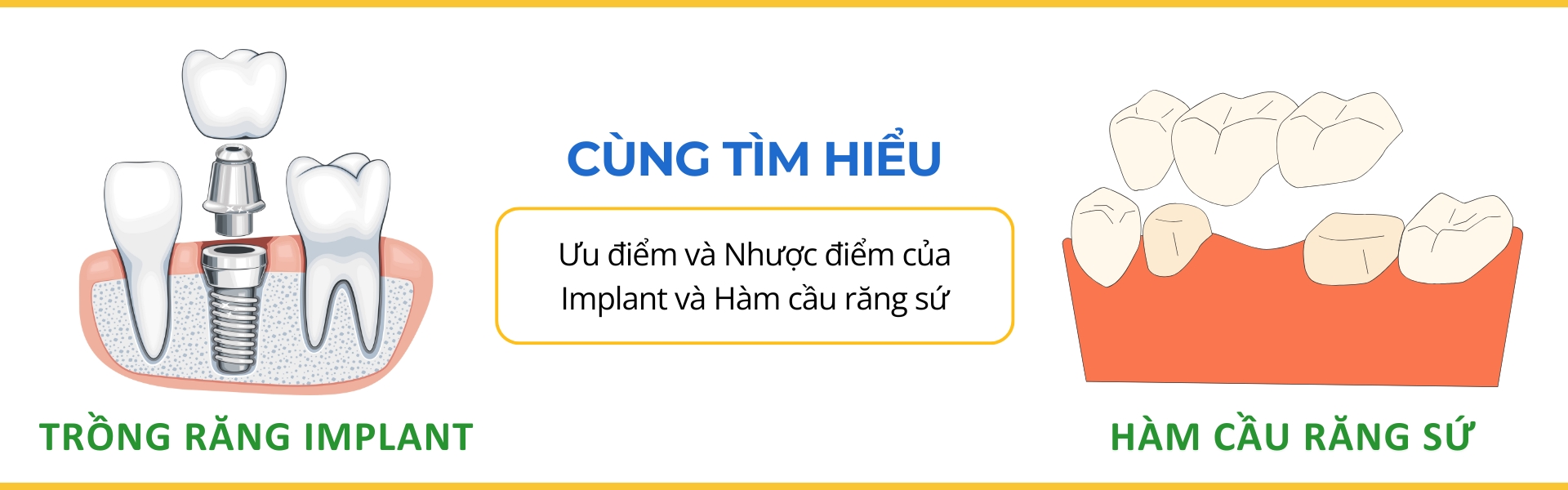 trong-rang-implant-ham-cau-rang-su-nha-khoa-ha-thanh