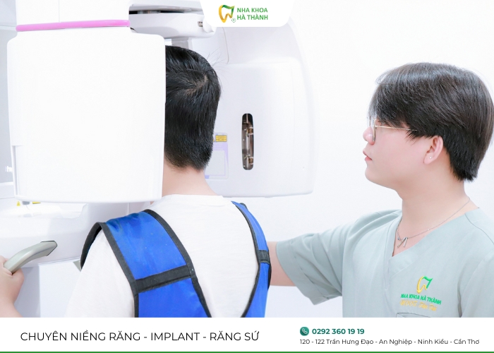 implant-nha-khoa-ha-thanh 6