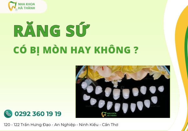 rang-su-nha-khoa-ha-thanh