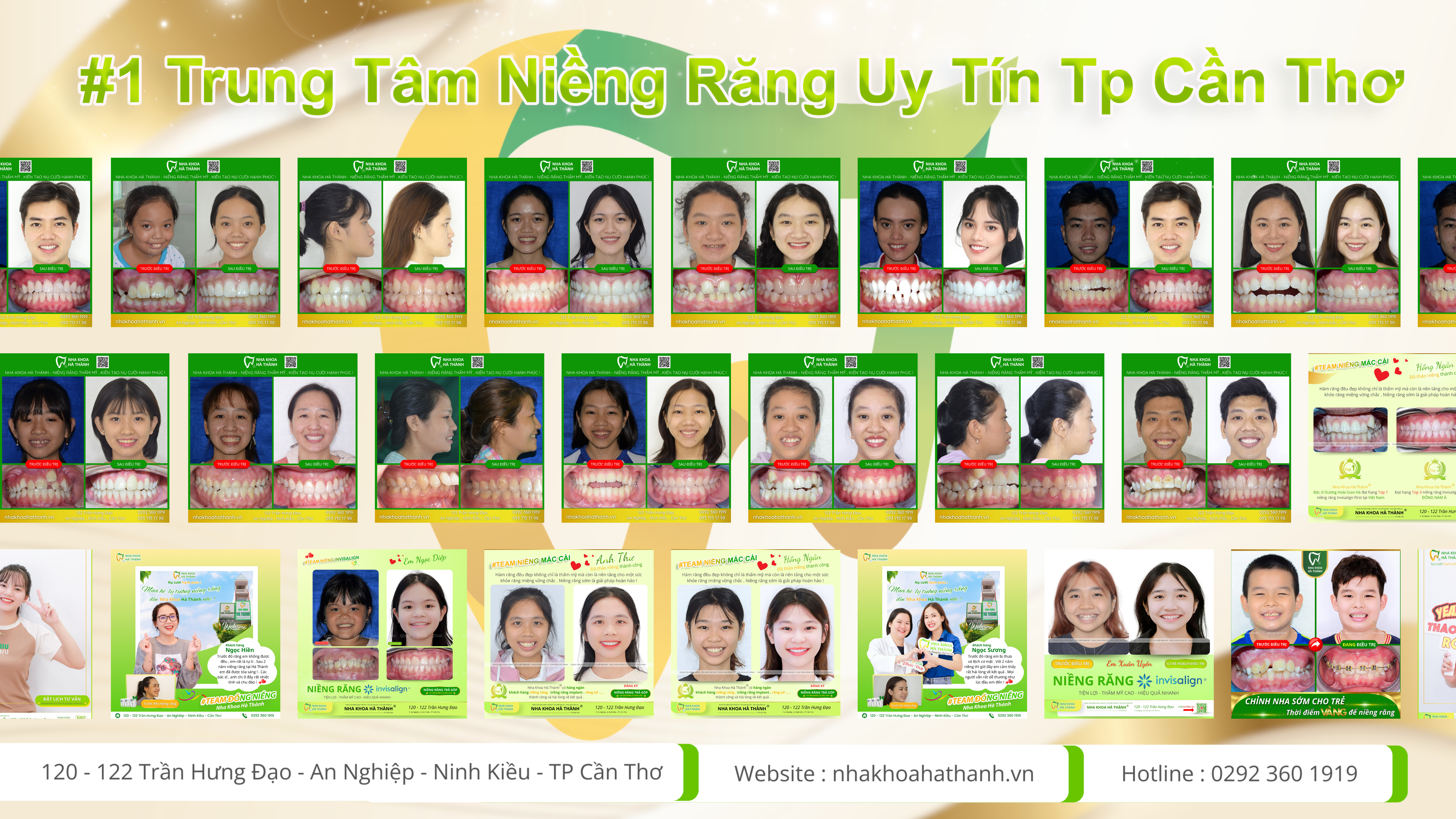 Nha khoa uy tín cần thơ-niềng răng uy tín-nha khoa hà thành