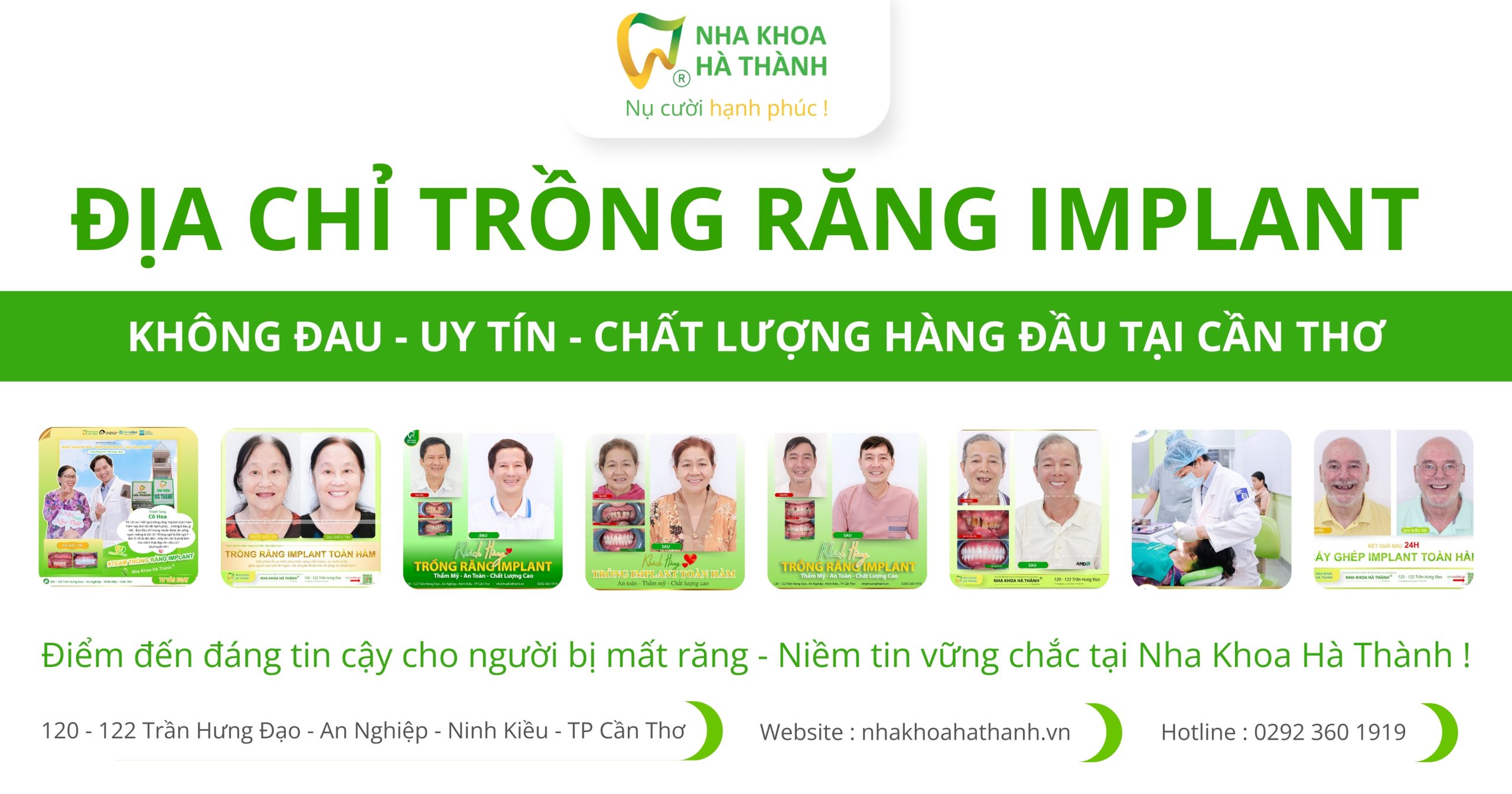 địa chỉ trồng răng implant không đau - uy tín ở cần thơ