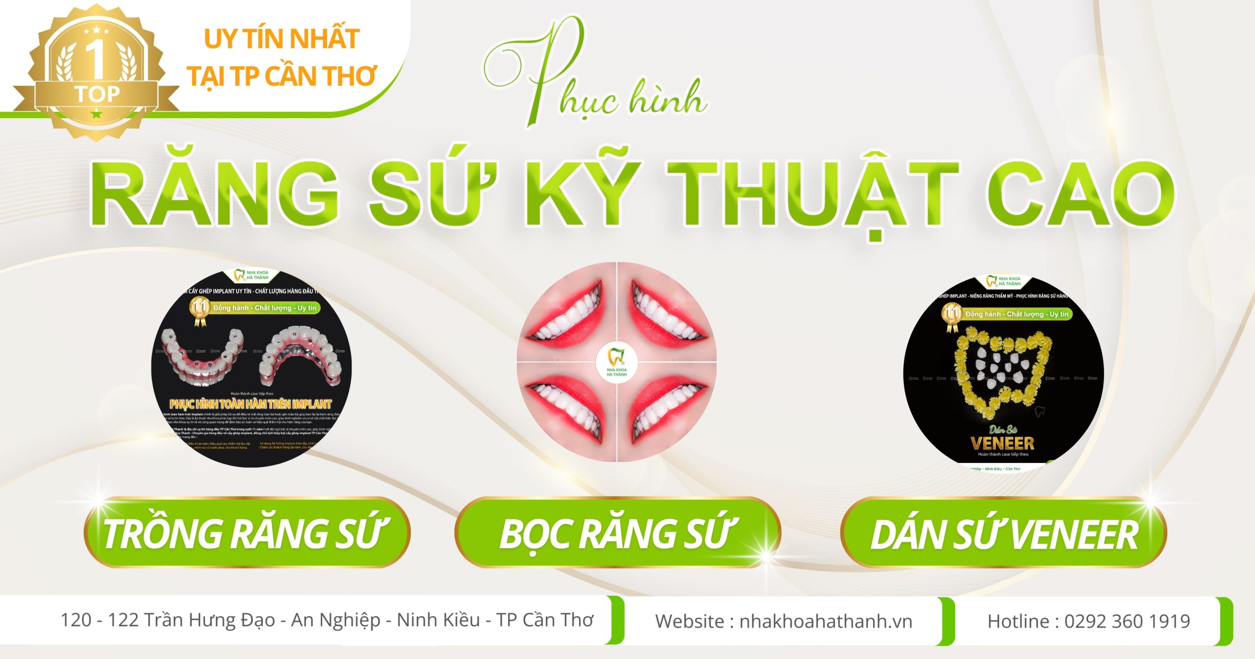 nha khoa trồng răng sứ - bọc răng sứ , dán sứ veneer uy tín nhất cần thơ