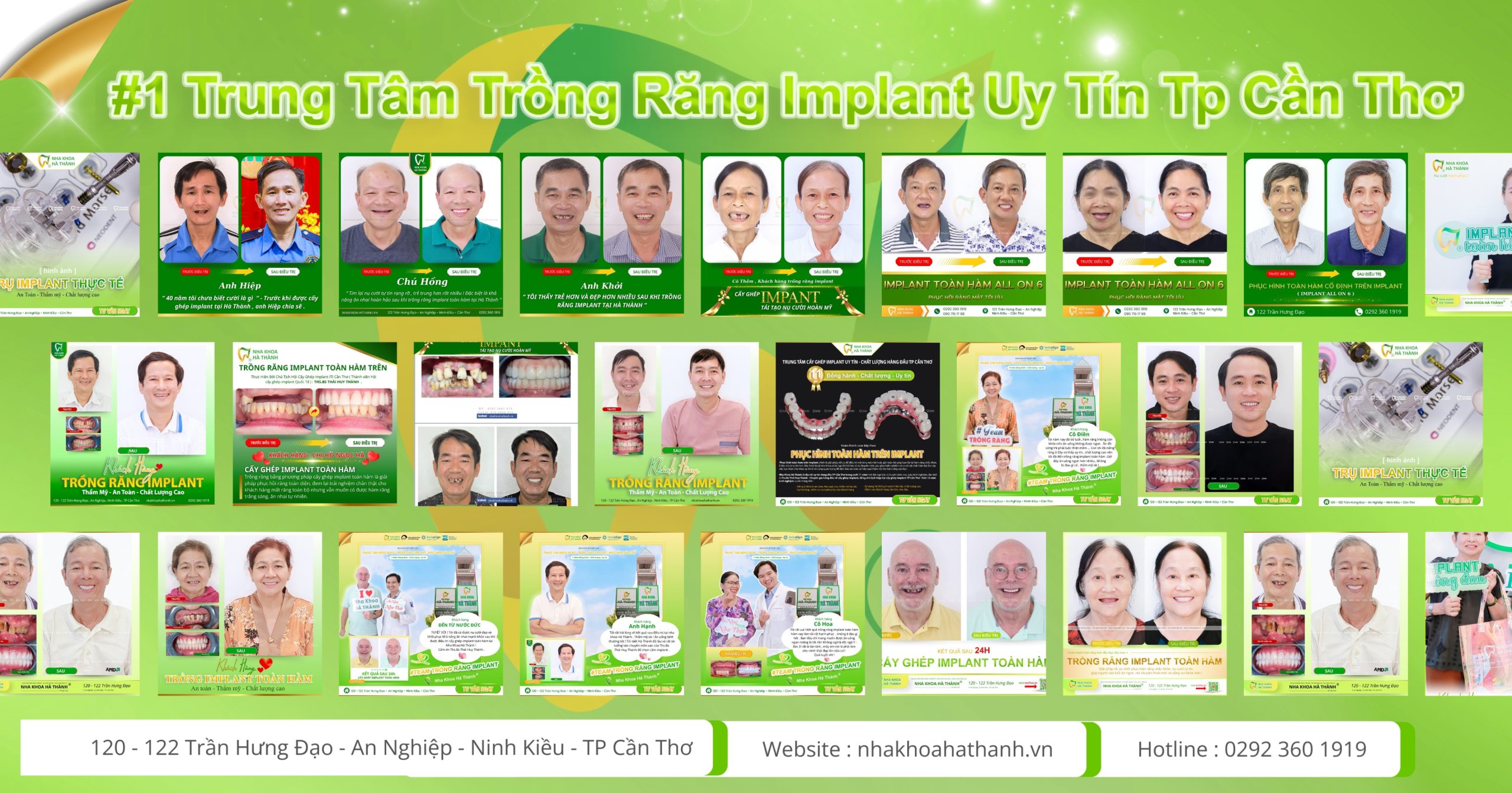 nha khoa uy tín nhất ở cần thơ-trồng răng-răng sứ-niềng răng-nha khoa hà thành