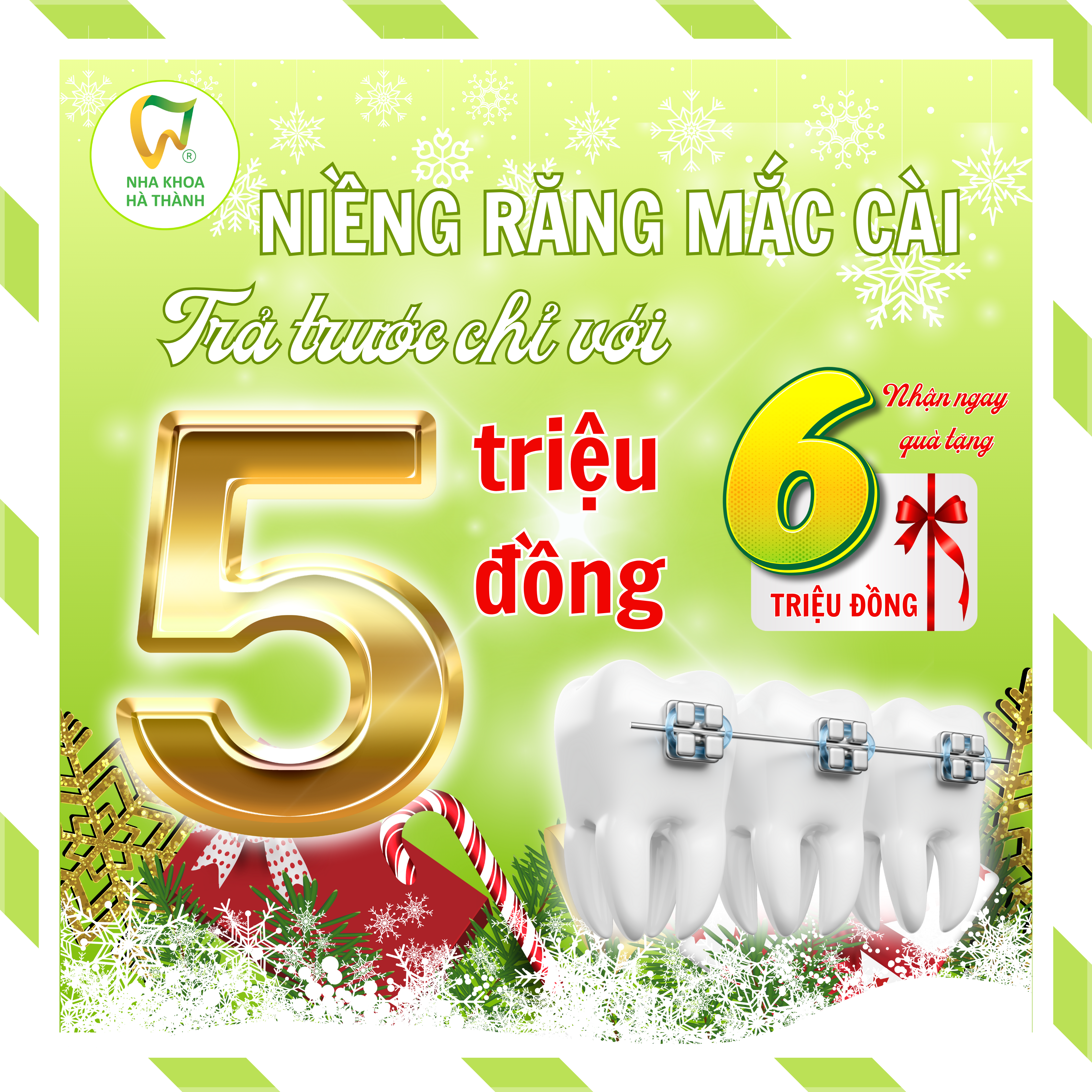 niềng răng mắc cài - nha khoa hà thàn tự đong cần thơ - nha khoa uy tín 