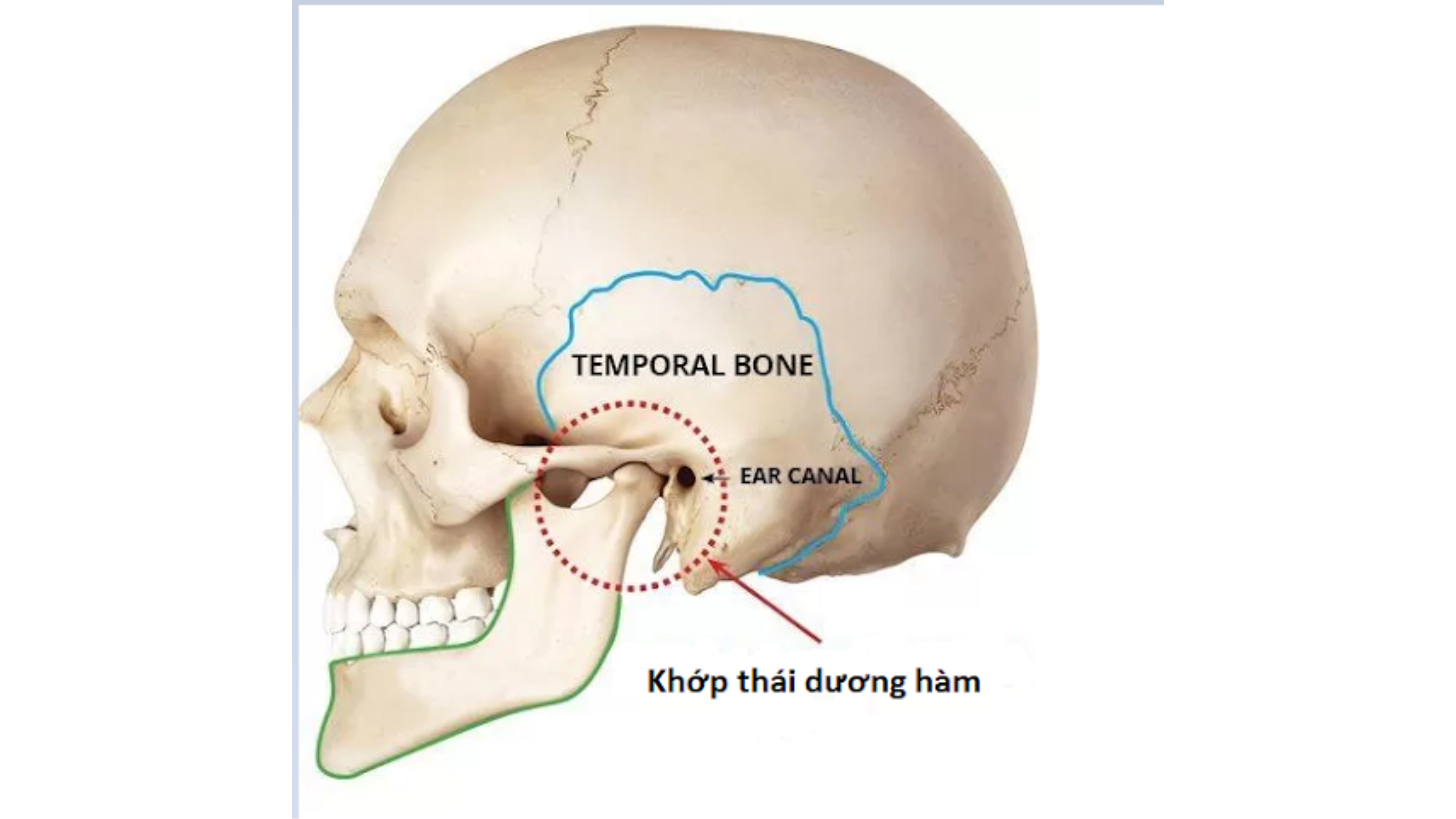 rối loạn khớp thái dương hàm-nha khoa uy tín điều trị khớp thái dương hàm ở Cần Thơ-nha khoa hà thành