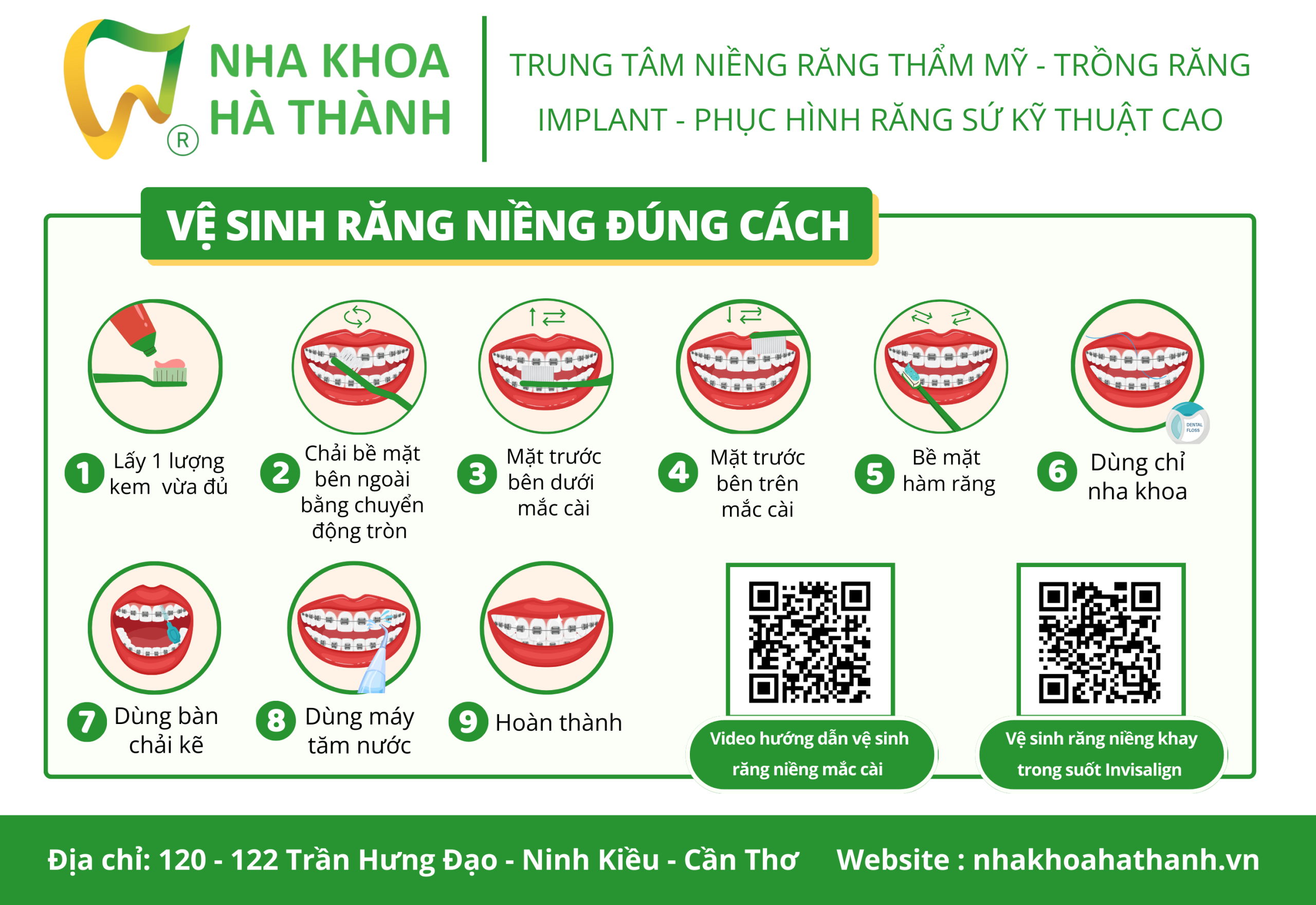 niềng-răng-mắc-cài-cánh-cam-nha-khoa-uy-tín-cần-thơ-nha-khoa-hà-thành