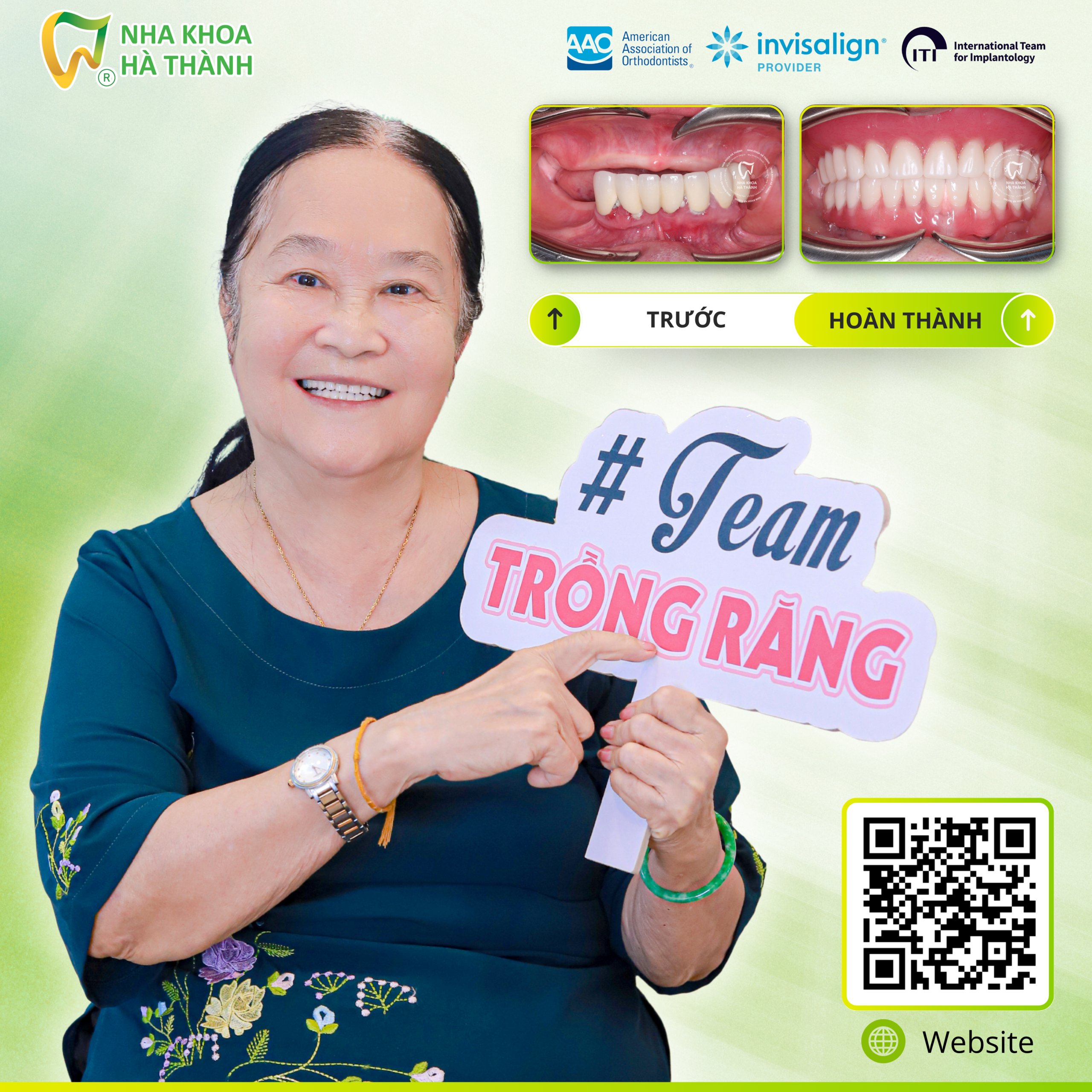 trồng-răng-implant-cấy-ghép-implant-nha-khoa-uy-tin-can-tho-nha-khoa-ha-thanh-bác-si-huy-thanh